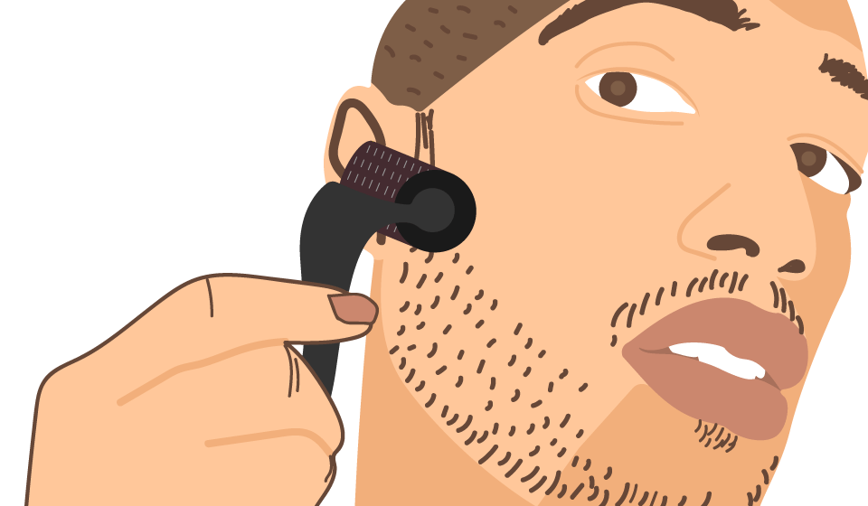 Dermaroller 0,5 Mm Für Bartwuchs & Haarwachstum – Microneedling-Set Mit Serum Für Männer